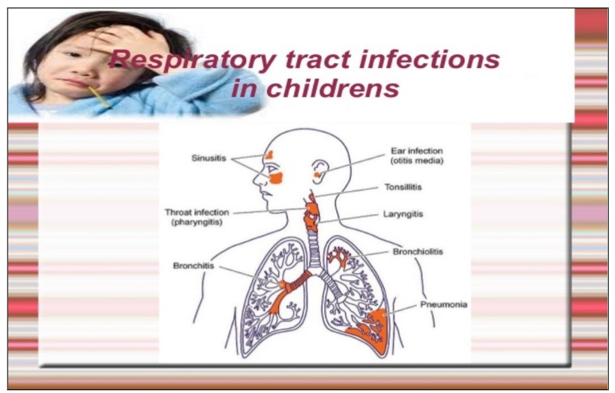 Seasonal outbreak of acute respiratory infections and role of belladonna as a “Genus homeopathic remedy”