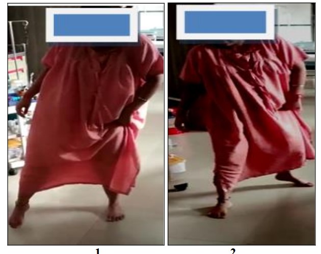 Vulvovaginitis – genital tract infection